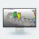 Magic Model 3D Implant | Implantatmodul f&uuml;r Dental...